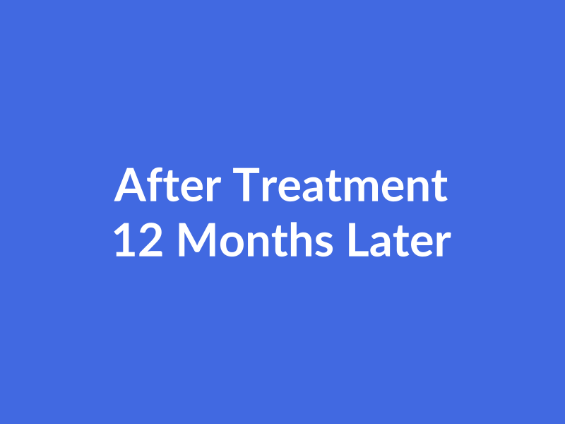 Hair Weaving Transformation - After